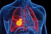 Harnessing the immune system in lung cancer: emerging role of the microbiome